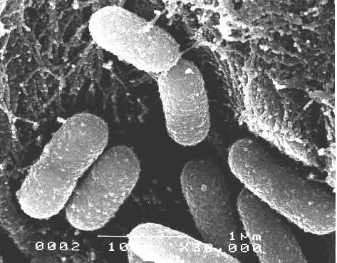 Biosigma y su Biolixiviación son Premiadas